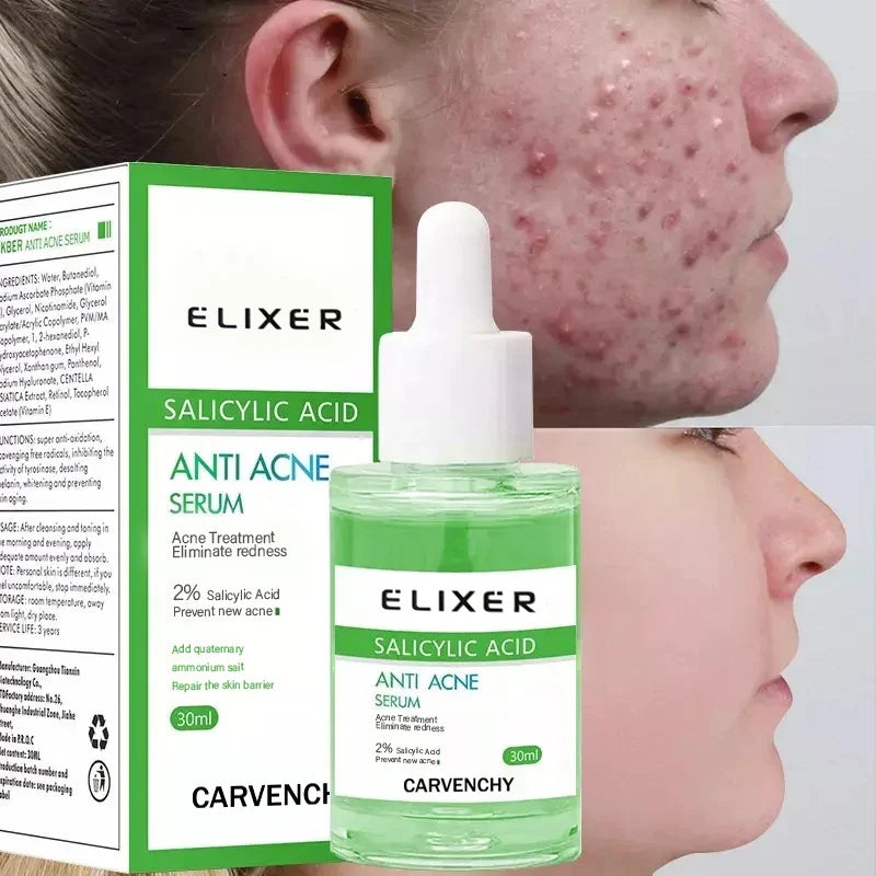 Anti-Blemish Calming & Moisturizing Face Cream Skin Tightening