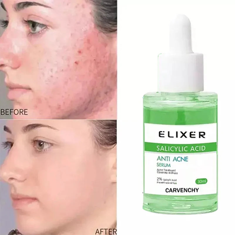 Anti-Blemish Calming & Moisturizing Face Cream Skin Tightening